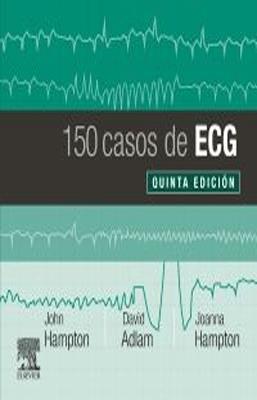 150 CASOS DE ECG 5ED