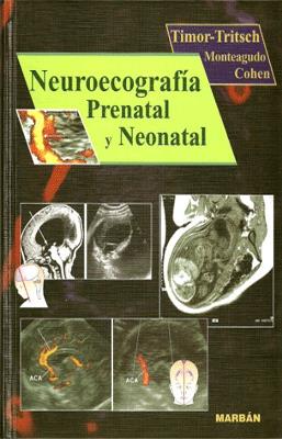 NEUROECOGRAFIA PRENATAL Y NEONATAL