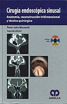 CIRUGIA ENDOSCOPICA SINUSAL ANATOMIA RECONSTRUCCION TRIDIMENSIONAL Y TECNICA QUIRURGICA +DVD 2ED