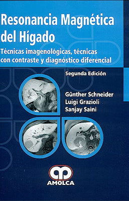 RESONANCIA MAGNETICA DEL HIGADO TECNICAS IMAGENOLOGICAS, TECNICAS CON CONTRASTE Y DIAGNOSTICO DIFER