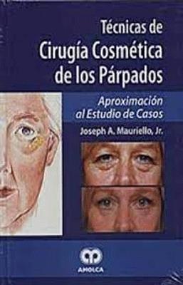 TECNICAS DE CIRUGIA COSMETICA DE LOS PARAPADOS