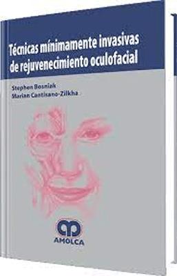 TECNICAS MINIMAMENTE INVASIVAS DE REJUVENECIMIENTO OCULOFACIAL