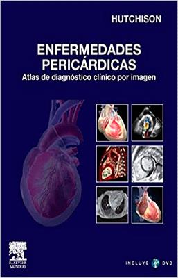 ENFERMEDADES PERICARDIACAS +CD