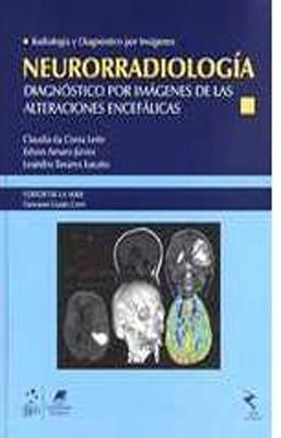 NEURORRADIOLOGIA DIAGNOSTICO POR IMAGENES DE LAS ALTERACIONES ENCEFALICAS