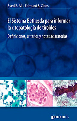 EL SISTEMA BETHESDA PARA INFORMAR LA CITOPATOLOGIA DE TIROIDES