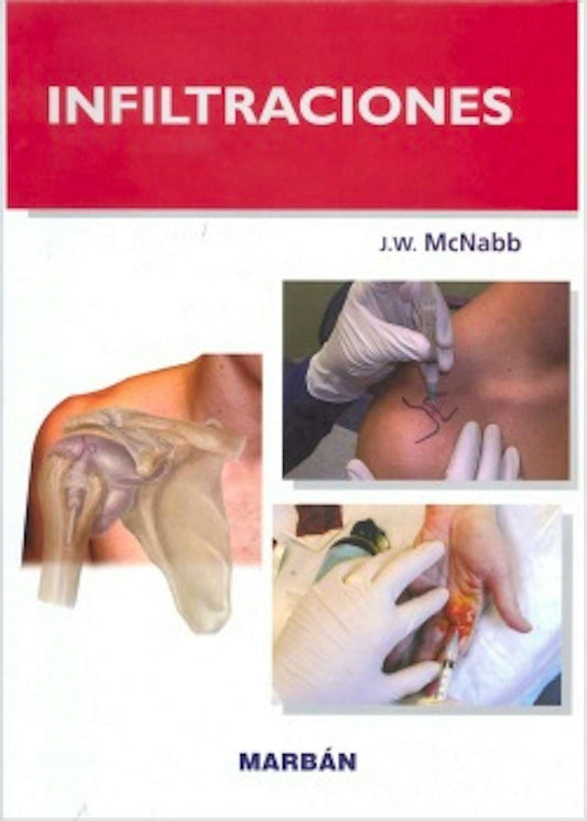 Infiltraciones Handbook