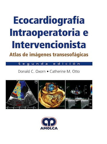 Ecocardiografía Intraoperatoria e Intervencionista Atlas de imágenes transesofágicas Segunda edición